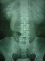 casestudy1_clip_image002_0002