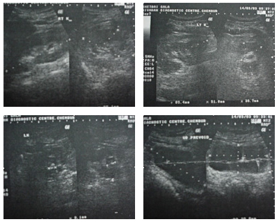 Urology treatment Case Studies
