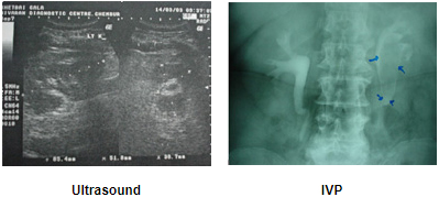 Urology treatment Case Studies